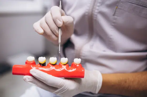 5 Restorative Treatments You Didn't Know You Might Need